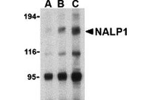 Western Blotting (WB) image for anti-NLR Family, Pyrin Domain Containing 1 (NLRP1) (C-Term) antibody (ABIN1030530)