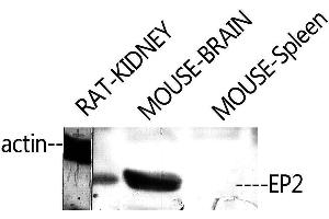 Western Blotting (WB) image for anti-Prostaglandin E Receptor 2 (Subtype EP2), 53kDa (PTGER2) (C-Term) antibody (ABIN3184492) (PTGER2 antibody  (C-Term))