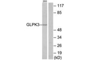 Western Blotting (WB) image for anti-Glycerol Kinase (GK) (AA 21-70) antibody (ABIN2889590) (Glycerol Kinase antibody  (AA 21-70))