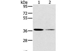 Western Blot analysis of 293T and Raji cell using SMN1 Polyclonal Antibody at dilution of 1:200 (SMN1 antibody)