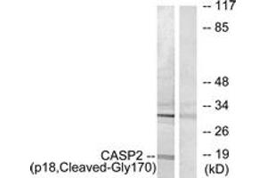Western blot analysis of extracts from Jurkat cells, treated with etoposide 25uM 24h, using Caspase 2 (p18,Cleaved-Gly170) Antibody. (Caspase 2 antibody  (Cleaved-Gly170))