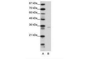 Image no. 1 for anti-Zinc Finger Protein 177 (ZNF177) (N-Term) antibody (ABIN6736158) (ZNF177 antibody  (N-Term))