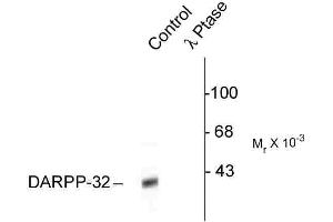 Western blots of rat caudate lysate showing specific immunolabeling of the ~32k DARPP-32 phosphorylated at Thr34 (Control). (DARPP32 antibody  (pThr34))