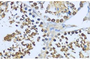 Immunohistochemistry of paraffin-embedded Mouse testis using HSP90AA1 Polyclonal Antibody at dilution of 1:200 (40x lens). (HSP90AA1 antibody)