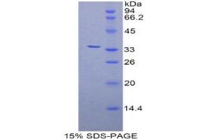 SDS-PAGE (SDS) image for zeta-Chain (TCR) Associated Protein Kinase 70kDa (ZAP70) (AA 337-600) protein (His tag) (ABIN1877931)