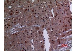 Immunohistochemistry (IHC) analysis of paraffin-embedded Rat Brain, antibody was diluted at 1:100. (RAB26 antibody  (C-Term))