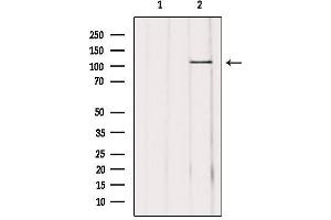 Western blot analysis of extracts from mouse brain, using USP11 Antibody. (USP11 antibody  (Internal Region))