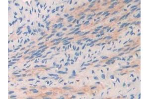 DAB staining on IHC-P; Samples: Mouse Oviduct Tissue (COL2A1 antibody  (AA 1307-1383))