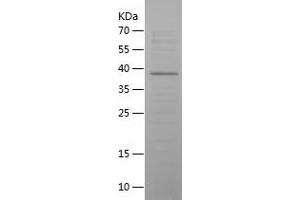 Western Blotting (WB) image for Vasoactive Intestinal Peptide (Vip) (AA 26-170) protein (His-IF2DI Tag) (ABIN7283385) (Vip Protein (AA 26-170) (His-IF2DI Tag))