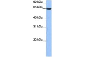 Western Blotting (WB) image for anti-Collagen, Type IV, alpha 3 (Goodpasture Antigen) Binding Protein (COL4A3BP) antibody (ABIN2463516) (COL4A3BP antibody)