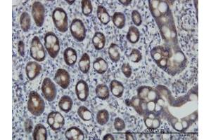 Image no. 1 for anti-Zinc Finger Protein 259 (znf259) (AA 361-460) antibody (ABIN598588) (ZNF259 antibody  (AA 361-460))