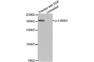 Western blot analysis of extracts from A431 cells using Phospho-ERBB3-Y1328 Antibody (ERBB3 antibody  (pTyr1328))