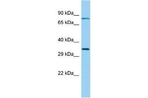 Host: Rabbit Target Name: RSPH9 Sample Type: Fetal Lung lysates Antibody Dilution: 1. (RSPH9 antibody  (Middle Region))