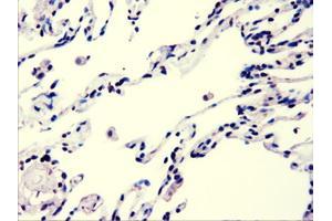 Immunohistochemical staining of paraffin-embedded lung using anti-AKT3 (ABIN2452528) mouse monoclonal antibody. (AKT3 antibody)