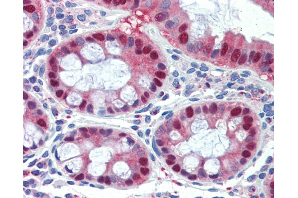 SCML1 antibody  (AA 108-157)