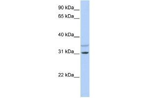 WB Suggested Anti-KCNRG Antibody Titration:  0. (KCNRG antibody  (N-Term))