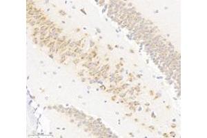 Immunohistochemistry analysis of paraffin-embedded mouse hippocampus using VAMP4 (ABIN7076198) at dilution of 1: 3000 (VAMP4 antibody)