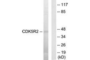 Western Blotting (WB) image for anti-Cyclin-Dependent Kinase 5, Regulatory Subunit 2 (p39) (CDK5R2) (AA 81-130) antibody (ABIN2889572) (CDK5R2 antibody  (AA 81-130))