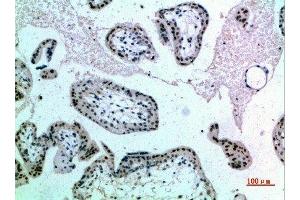 Immunohistochemical analysis of paraffin-embedded human-placenta, antibody was diluted at 1:200 (NOP56 antibody  (AA 191-240))