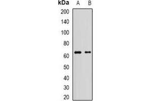 Western blot analysis of AF9 expression in Jurkat (A), A549 (B) whole cell lysates. (AF9 antibody)