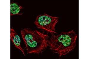 Fluorescent confocal image of HeLa cell stained with CUX1 antibody at 1:25.