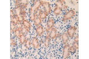 Used in DAB staining on fromalin fixed paraffin- embedded Kidney tissue (PLXNB1 antibody  (AA 1598-1849))
