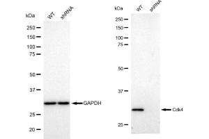 Western blotting analysis using Cdk4 antibody (ABIN7798214). (Recombinant CDK4 antibody)