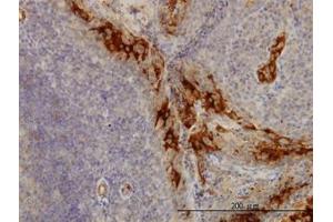 Image no. 1 for anti-Tumor Necrosis Factor Receptor Superfamily, Member 6b, Decoy (TNFRSF6B) (AA 32-142) antibody (ABIN599064) (TNFRSF6B antibody  (AA 32-142))
