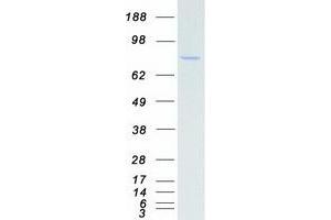 Western Blotting (WB) image for Ribosomal Protein S6 Kinase, 90kDa, Polypeptide 6 (RPS6KA6) protein (Myc-DYKDDDDK Tag) (ABIN2731178)