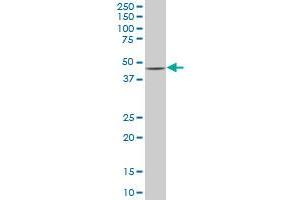 SMAD7 monoclonal antibody (M07), clone 4G11. (SMAD7 antibody  (AA 160-260))