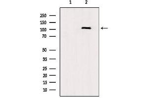 Western blot analysis of extracts from rat brain, using TLR8  Antibody. (TLR8 antibody  (C-Term))