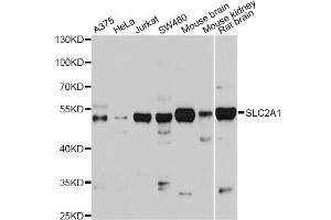 Western blot analysis of extracts of various cell lines, using SLC2A1 antibody (ABIN2559969) at 1:1000 dilution. (GLUT1 antibody)