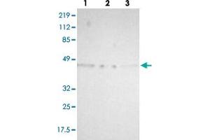 Western blot analysis of lane 1: RT-4, lane 2: U-251 MG and lane 3: A-431 cell lysates using TXNDC4 polyclonal antibody . (ERP44 antibody)