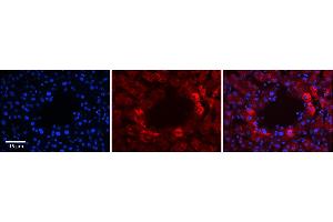 Rabbit Anti-RABL4 Antibody      Formalin Fixed Paraffin Embedded Tissue: Human Adult Liver   Observed Staining: Cytoplasm in hepatocytes surrounding the portal vein only, signal is strong but tissue abundance is low  Primary Antibody Concentration: 1:100  Secondary Antibody: Donkey anti-Rabbit-Cy3  Secondary Antibody Concentration: 1:200  Magnification: 20X  Exposure Time: 0. (RABL4 antibody  (C-Term))