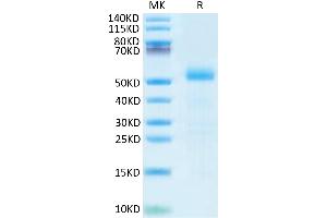 Mouse DLL3 on Tris-Bis PAGE under reduced  condition. (DLL3 Protein (AA 25-488) (His tag))