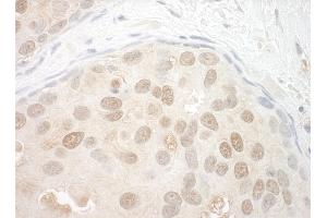 anti-Origin Recognition Complex Subunit 2 (ORC2) (AA 150-200) antibody