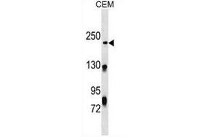 NHSL1 Antibody (Center) (ABIN1538546 and ABIN2849679) western blot analysis in CEM cell line lysates (35 μg/lane). (NHSL1 antibody  (AA 632-661))