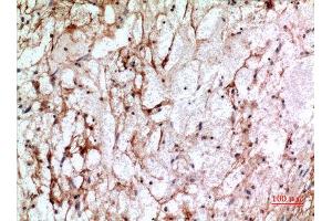 Immunohistochemistry (IHC) image for anti-Interferon-Induced Transmembrane Protein 1 (IFITM1) (N-Term) antibody (ABIN3187970)