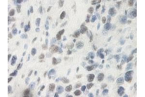 Image no. 2 for anti-Oncostatin M (OSM) antibody (ABIN465829) (Oncostatin M antibody)