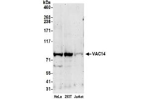 anti-Vac14 Homolog (VAC14) (AA 732-782) antibody