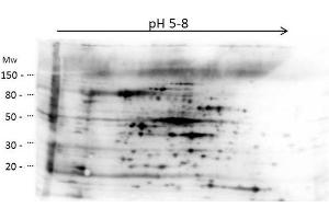 2D Western Blot of anti-E. (HMW HCP antibody)