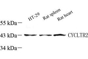 Western blot analysis of CysLT2 (ABIN7073655),at dilution of 1: 60