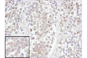 Immunohistochemistry (IHC) image for anti-Ubiquitin Carboxyl-terminal Esterase L3 (Ubiquitin Thiolesterase) (Uchl3) (AA 174-224) antibody (ABIN7453807)