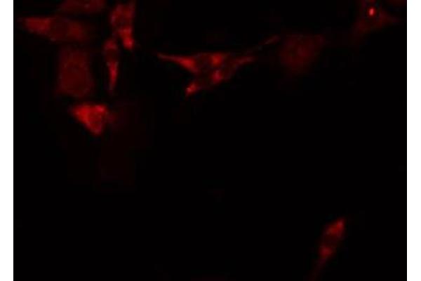 ABCC12 antibody  (Internal Region)