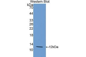 Western Blotting (WB) image for anti-Interleukin 12 Receptor, beta 2 (IL12RB2) (AA 559-647) antibody (ABIN3207283) (IL12RB2 antibody  (AA 559-647))