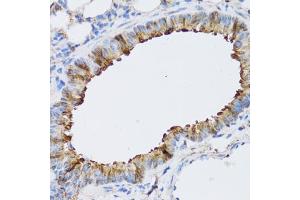 Immunohistochemistry (IHC) image for anti-ARD1 Homolog, N-Acetyltransferase (ARD1A) (AA 161-235) antibody (ABIN6144318)