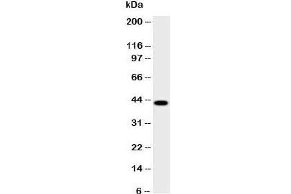 HSD17B2 anticorps  (AA 373-387)