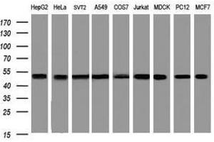 Image no. 5 for anti-SERPINE1 mRNA Binding Protein 1 (SERBP1) (AA 1-262) antibody (ABIN1490676)