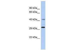 C11ORF46 antibody used at 1 ug/ml to detect target protein. (C11orf46 antibody  (N-Term))