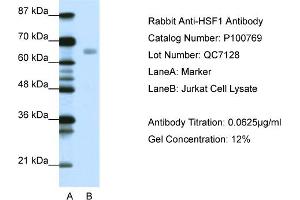 WB Suggested Anti-HSF1  Antibody Titration: 0. (HSF1 antibody  (C-Term))